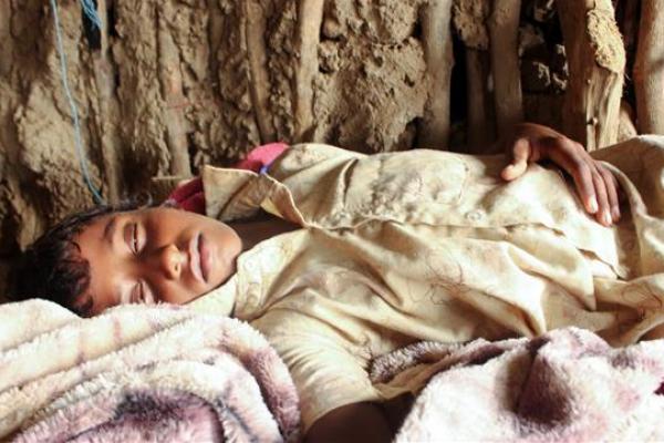 Demam Berdarah Renggut Puluhan Nyawa Anak di Yaman