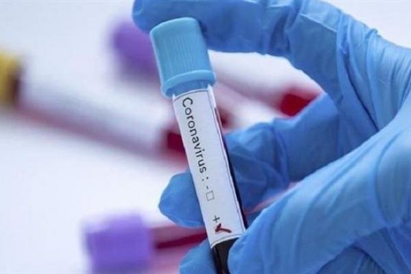 Virus Corona Disebut Diproduksi di Laboratorium