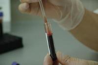 Transfusi Plasma Darah Kurangi Resiko Kematian Pasien Covid-19