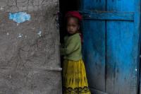 Miris, 100.000 Ethiopia Alami Kekurangan Gizi Akut